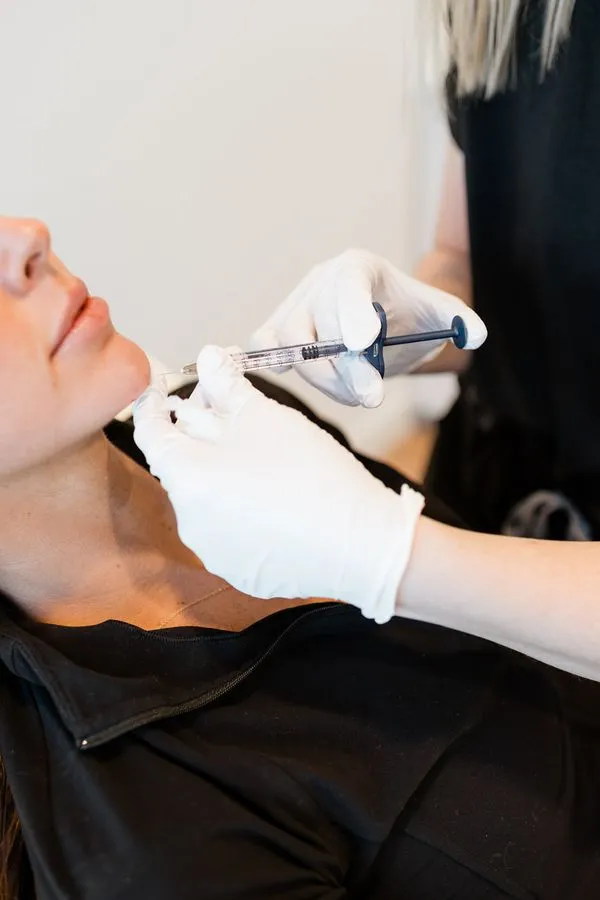 Resultado de harmonização facial com harmonia natural dos traços